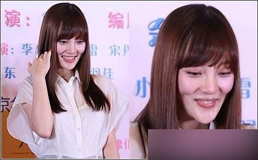 王贝整容失败的原因（被整容坑苦的五位女星）(8)