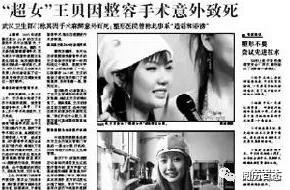 王贝整容失败的原因（被整容坑苦的五位女星）(10)