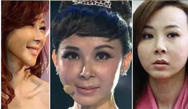 王贝整容失败的原因（被整容坑苦的五位女星）(3)