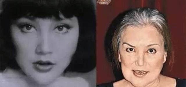 王贝整容失败的原因（被整容坑苦的五位女星）(12)