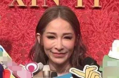 王贝整容失败的原因（被整容坑苦的五位女星）(6)