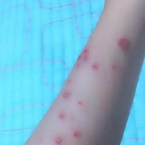 猫癣的症状和防治方法（猫病百科猫癣是啥）(4)