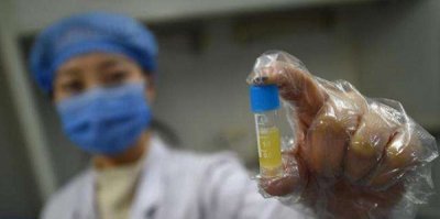 ​捐精子一次几钱?每个男性都不妨捐赠精子吗