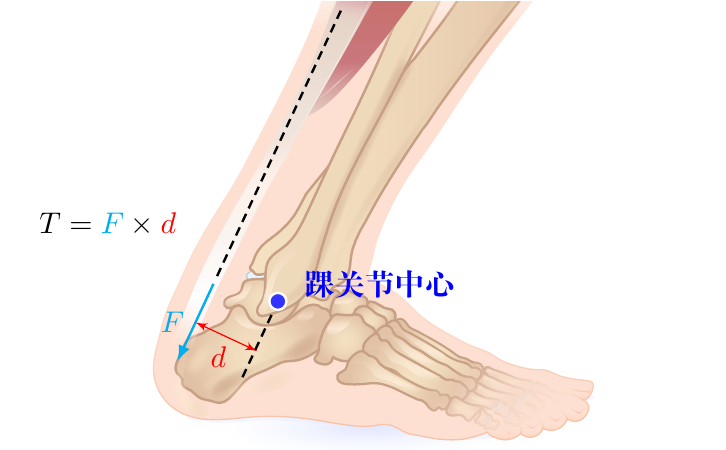 迈克尔·杰克逊 45 度前倾是怎么做到的？