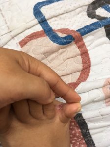 烂脚丫怎么办最快最有效的方法(一穿鞋捂脚就烂脚丫子……这几招不用花钱轻轻
