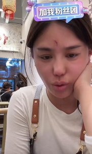 ​千万网红樊小慧被封号！自曝被婆婆殴打，网友发现3点疑点