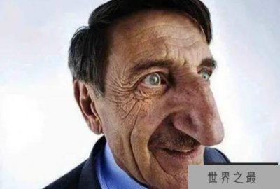 ​世界上鼻子最长的人 现在已经去世（最长鼻子）