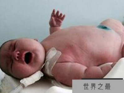 ​世界上出生最重的婴儿，澳大利亚产妇诞下37斤巨婴