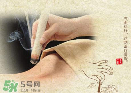 三伏灸和艾灸的区别_三伏灸是艾灸吗