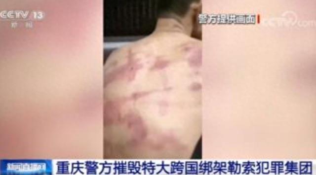 探秘如果大量美国人被割了腰子,缅北会是什么下场?很过瘾但也很危险 3