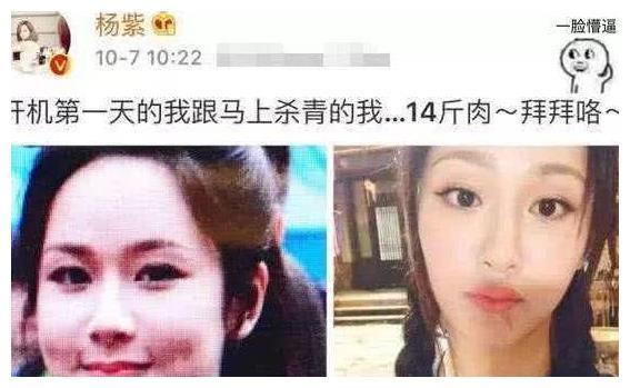 杨紫自曝减肥秘籍,15天瘦22斤,网友:怪不得一下子变化这么大