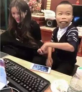 满口龅牙的他，竟一度成为网红