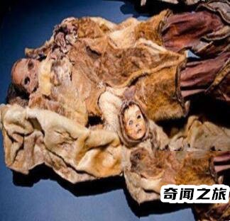巨人观恐怖照片儿（巨人观可怕不）(2)_