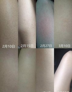 ​有什么方法可以快速去鸡皮(去鸡皮的小妙招)