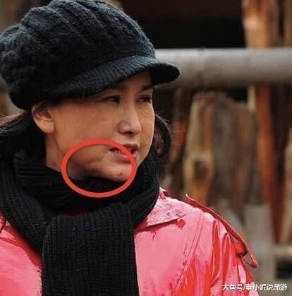 她是《重案六组》最美警花，嫁大23岁导演，如今整容失败面目全非