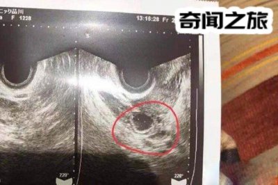 ​蒋劲夫家暴女友的原因（和很多男性友人一起去夜店玩）