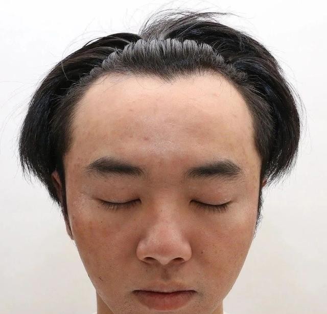 华晨宇整容前后照片（华晨宇从眼镜宅男到花样美男）