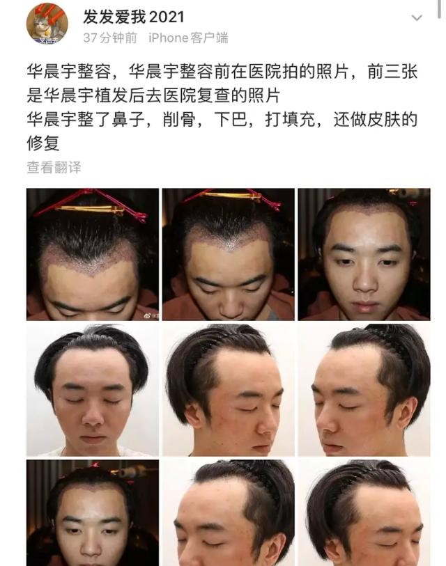 华晨宇整容前后照片（华晨宇从眼镜宅男到花样美男）