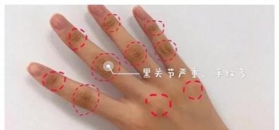 ​14岁美白方法(14岁学生快速美白的方法)