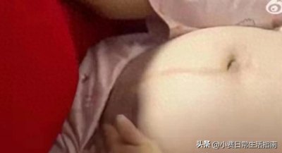 ​32周孕妇遭丈夫猛踢孕肚后续！皮肤青紫，知情人曝光内幕