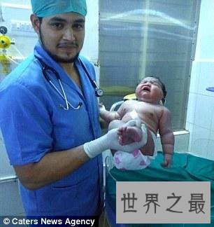 世界上最重的女婴,印度19岁女孩生13.6斤重巨婴
