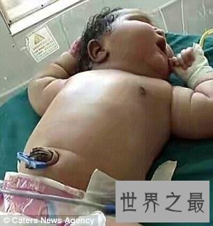 世界上最重的女婴,印度19岁女孩生13.6斤重巨婴