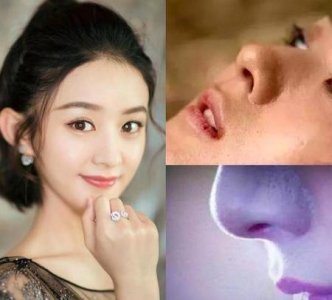 ​如何改善黑头和毛孔粗大(去黑头毛孔粗大小妙招)