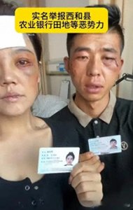 ​因妻子太美！夫妻俩被银行职员殴打囚禁照片曝光！凶手儿媳妇更美